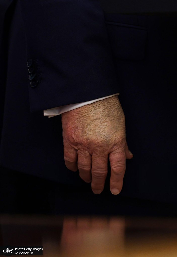 دست ترامپ جنجالی شد (3)