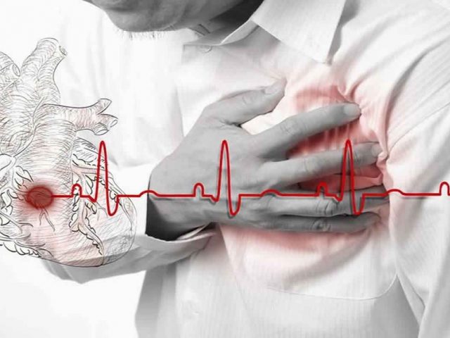 angina-pectoris-ozyrkfw8sila77mibebw2wlalad7mcy64c71i9ng74