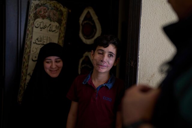 مجروحیت مردم لبنان در انفجار پیجرها