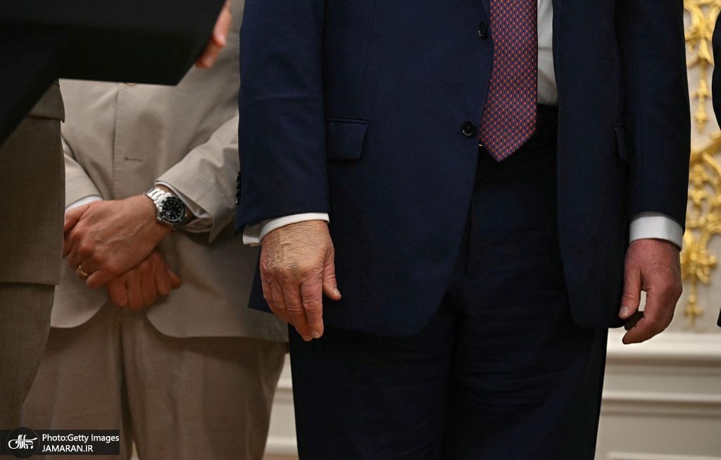 دست ترامپ جنجالی شد (1)