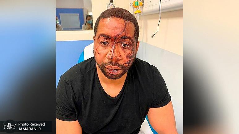 ضرب و جرح مرد سیاهپوست به دست پلیس فرانسه