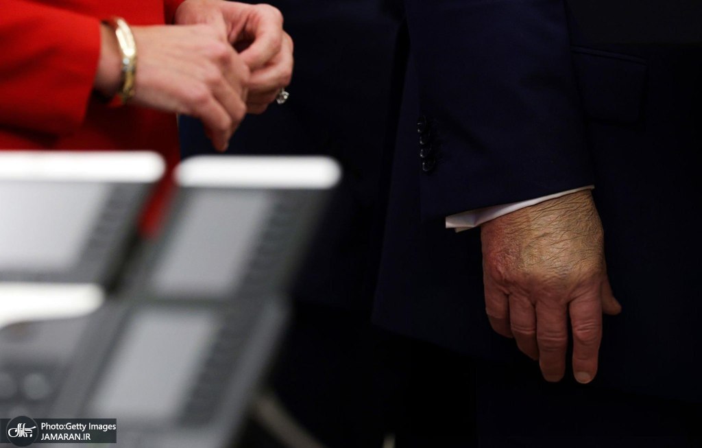 دست ترامپ جنجالی شد (2)