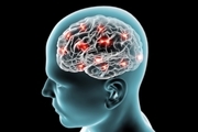  آسپرین و نقش آن در کاهش علائم آلزایمر