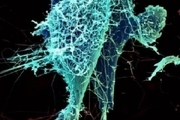 ویروس «ابولا» در ریه های بیمار تکثیر می شود
