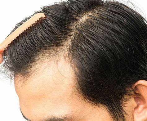 راهکارهای طب ایرانی کم هزینه برای تقویت مو
