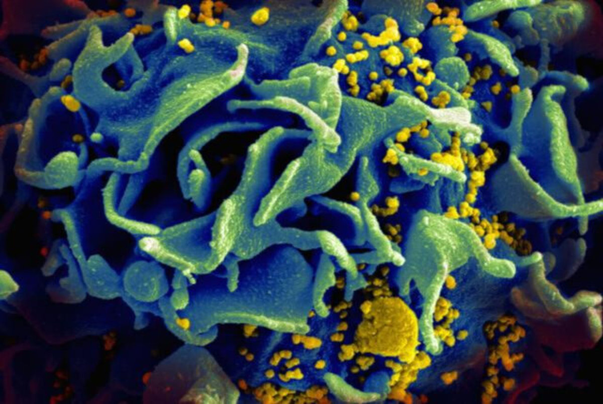 کشف ماده ای که ایمنی در برابر ایدز را افزایش می دهد