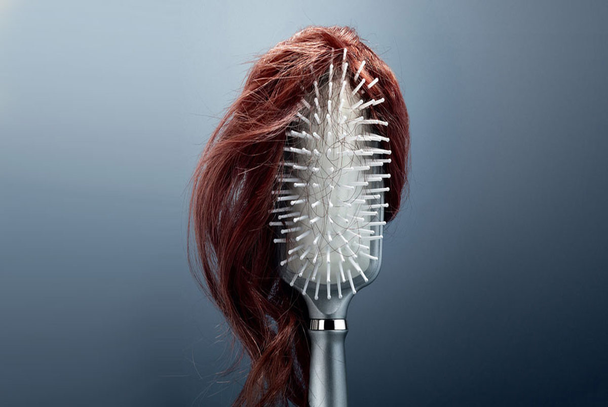 دلایل ریزش موی زنان بالای 40 سال + درمان ها