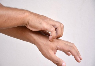 علائم جدید کرونا بر روی پوست