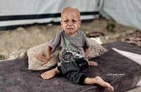  فریاد گرسنگی در چشمان یک کودک (5)