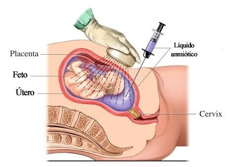 راه اندازی بخش تشخیص اختلالات کروموزومی و ژنتیکی در بیمارستان روحانی بابل