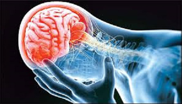 25 درصد سکته های مغزی در افراد کمتر از 55 سال رخ می دهد