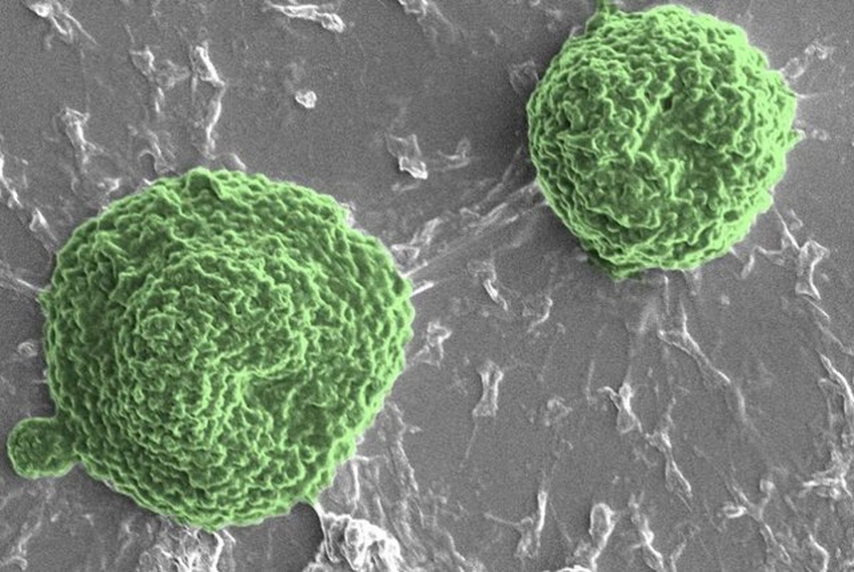 درمان سرطان با میکروربات‌های جلبکی!
