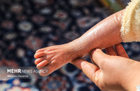 زخم های هانیه (5)