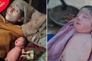 یک نوزاد بدون دست و پا در هند متولد شد+ عکس و فیلم