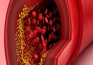 نقش مصرف چربی اشباع شده بر کاهش بیماری قلبی
