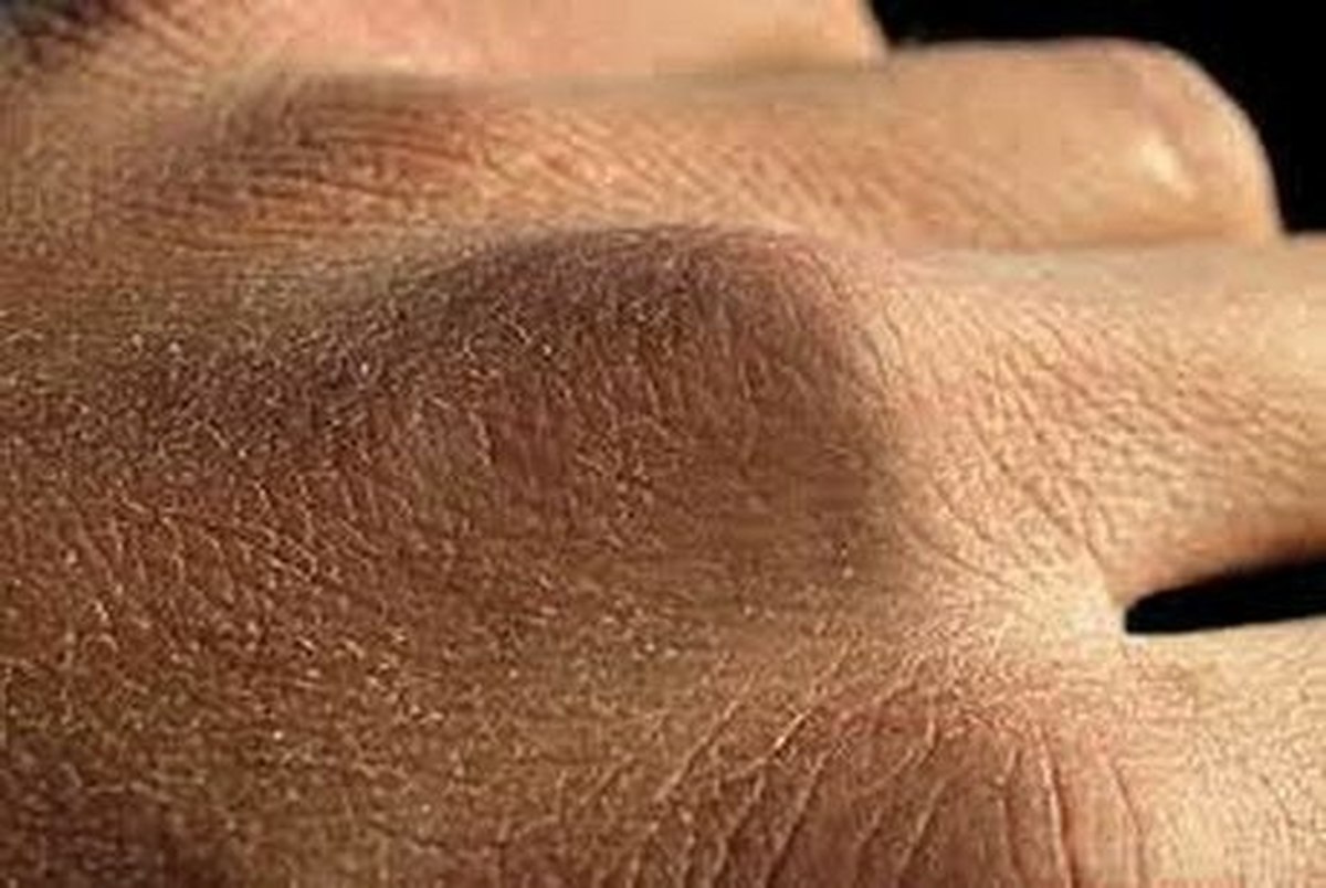 مراقبت از پوست دست در برابر شست و شوهای مداوم