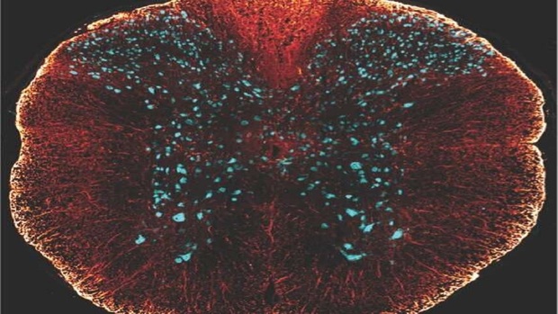 سرنخ‌های ترمیم آسیب نخاعی در سلول‌های زامبی
