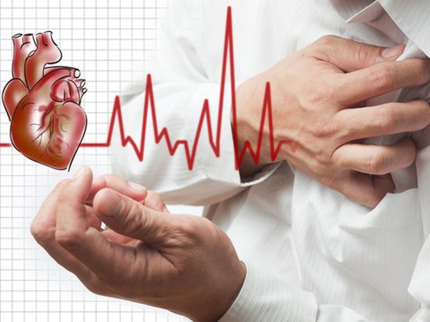 نیمی از سکته های قلبی قبل از بروز علائم داشته اند