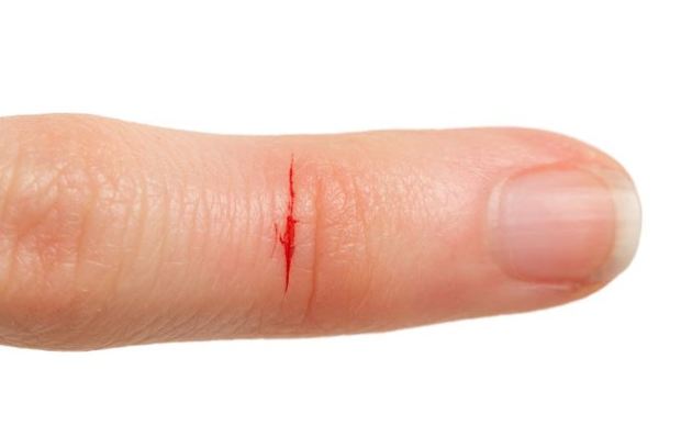 چرا برش دست با کاغذ مثل تیغ دردناک است؟ 