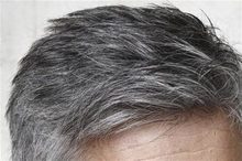 علت سفید شدن مو چیست؟