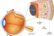 ساخت شبکیه مصنوعی هوشمند چشم
