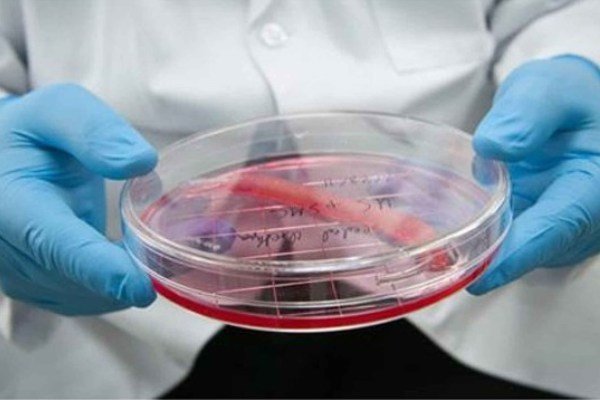 کشف شباهت های بین سلول های بنیادی جنینی و پرتوان القایی
