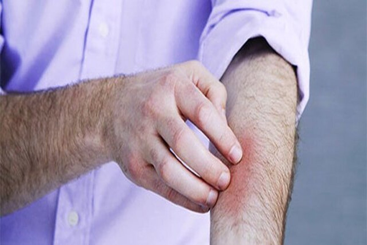 5 علامت مهم آسیب پوستی و راه های مقابله با آن