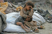  ۲۰۰۰ کودک زیر پنج سال مبتلا به سوءتغذیه در خراسان‌شمالی