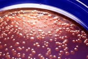 باکتری خون‌آشام؛ کشف جدید دانشمندان 