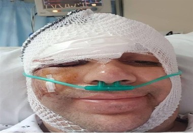 تصادف شدید امیر کربلایی‌زاده با اتوبوس+ عکس
