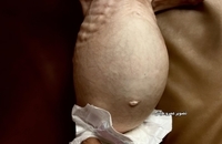 شام قدیح، کودک دو ساله فلسطینی (6)