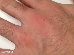 همه چیز درباره "گال"