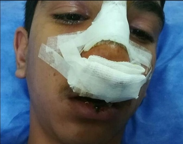 روایت کتک‌خوردن دلخراش یک دانش‌آموز جیرفتی/ عکس