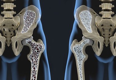 بیماری خاموشی که زنان را بیشتر از مردان تهدید می‌کند