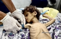شهادت کودک فلسطینی بر اثر گرسنگی در جنوب غزه (1)