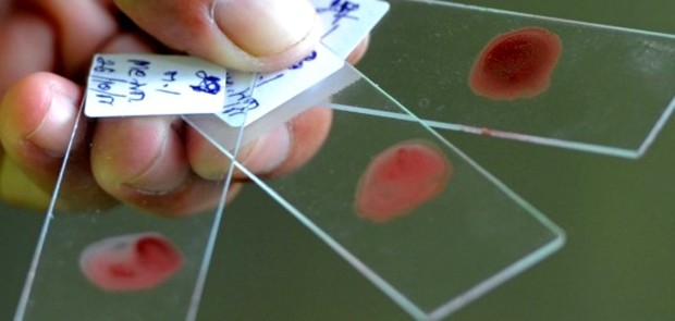 4500 نفر مشکوک به مالاریا در جیرفت مورد آزمایش قرار گرفتند