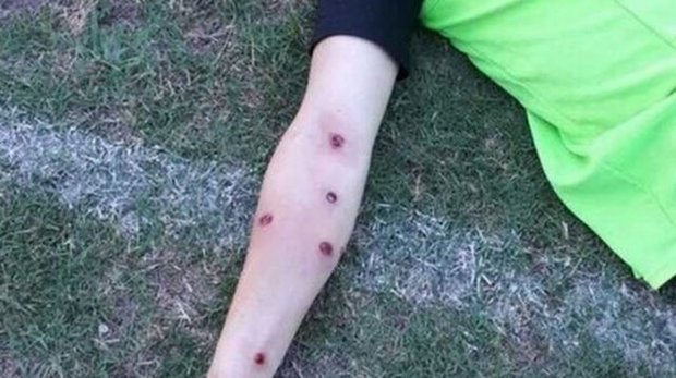 تیراندازی پلیس آرژانتین به بازیکنان فوتبال و هواداران! + تصاویر


