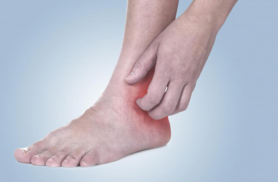 راهکار‌های خانگی برای رفع تیرگی قوزک پا، آرنج و زانو
