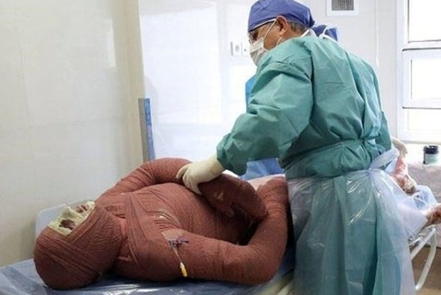 114 نفر بر اثر سوختگی در سیستان و بلوچستان فوت کردند