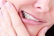ترفند‌هایی جالب برای محافظت از دندان‌ها در برابر زردی
