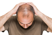 ژنتیک عامل ریزش مو در مردان