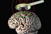 کشف روشی جدید برای ترک اعتیاد؛ تحریک الکترونیکی مغز