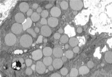 سلول‌ها برای جوان شدن «استفراغ» می‌کنند!
