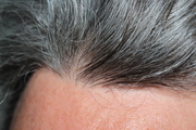 ارتباط جالب موهای خاکستری با سیستم ایمنی و عفونت ویروسی