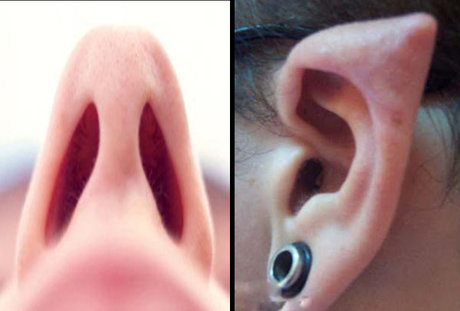 عمل زیبایی نامتعارف در ایران بیشتر از دنیا
