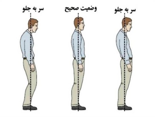 راه اندازی 9کانون حرکات اصلاح قامتی دانش‌آموزان در لرستان