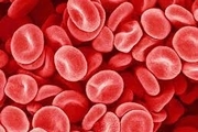 علامت اصلی پلاکت خون پایین چیست؟