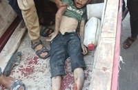 شهادت دردناک کودکان فلسطینی در حمله اسرائیل (5)