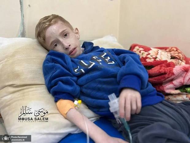 وضعیت وحشتناک کودک فلسطینی به خاطر قحطی ایجاد در غزه توسط اسرائیل + عکس ها