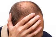 8 درمان طبیعی برای مقابله با نازکی مو